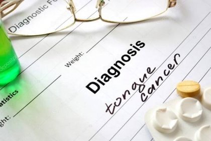 Stáhnout - Diagnóza rakovina jazyka psány diagnostický formulář a prášky. — Stock obrázek