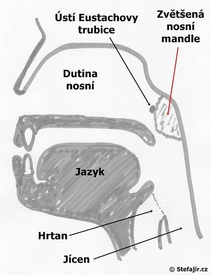 Nosní mandle - adenoidní vegetace | Medicína, nemoci, studium na 1. LF UK