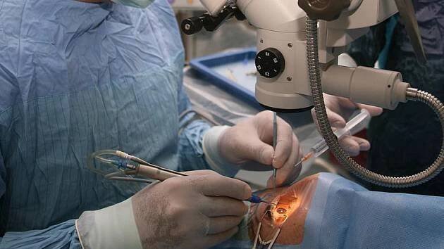 Už žádné transplantace rohovky? Čeští a britští vědci hlásí průlom v léčbě oka