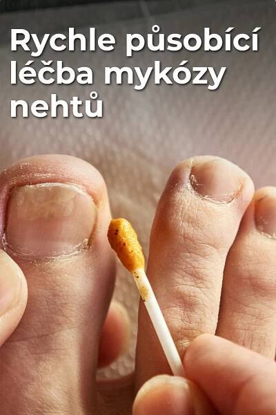 Odstraňte příčiny nehtové mykózy snadno | Body skin care routine, Body skin care, You nailed it