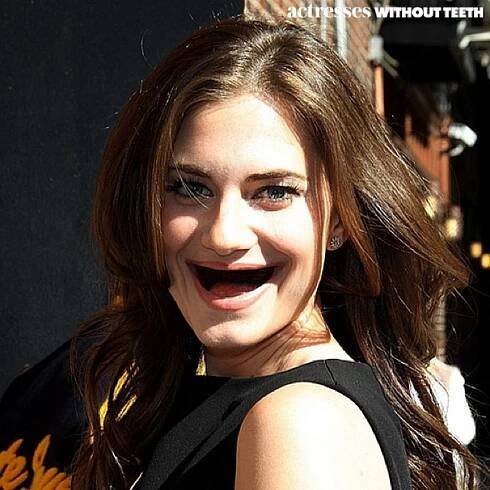 30 Famous No Teeth Celebrities Pictures