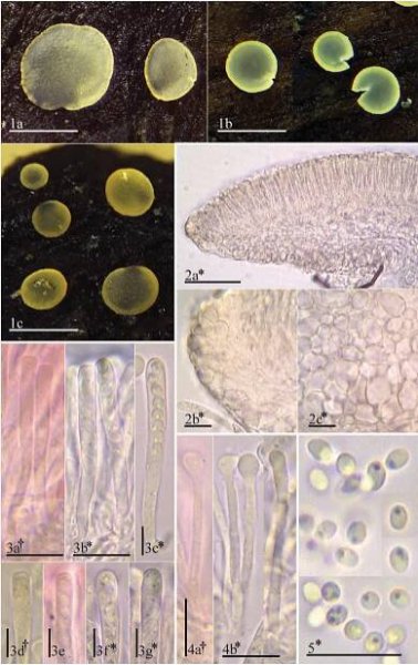 FIGURE 1. Morphological features of Orbilia cejpii. 1. Fresh apothecia. 2. Apothecium with excipular tissues in median section: 2a. Median section, 2b. Cells at margin, 2c. Cells at base. 3. Dead and living asci. 4. Dead and living paraphyses. 5. Living ascospores. 500 um= la—c; 50 um= 2a; 10 ym= 2b-c, 3a-b, 4a-b, 5a; 5 um= 3c—g. Mounted in: CR= 3a, 3e, 4a; H,O= 2a-c, 3b-c, 3f-g, 4b, 5; MLZ= 3d. All photos from TFC Mic. 23631. 