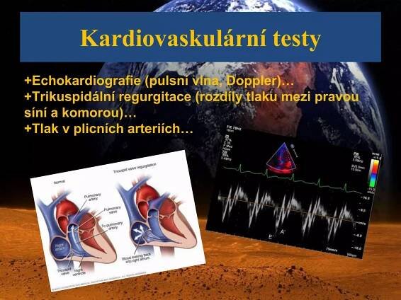Kardiovaskulární testy
+Echokardiografie (pulsní vlna, Doppler)…
+Trikuspidální regurgitace (rozdíly tlaku mezi pravou
síní a komorou)…
+Tlak v plicních arteriích…
 