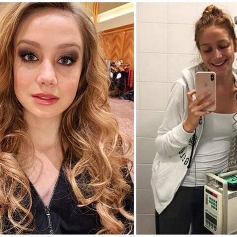 Anna Kadeřávková podle některých fanoušků boj se zákeřnou nemocí jen předstírá.