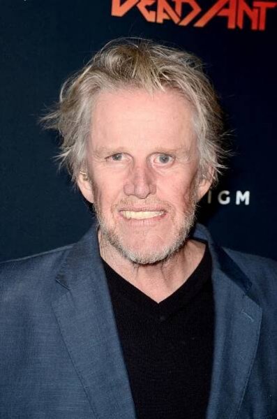 36 Beautiful and Famous Celebrities With Full Dentures