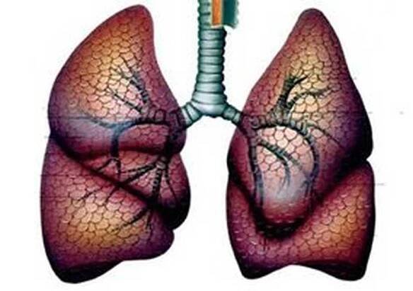 Příznaky, symptomy, prevence a léčba tuberkulózy u dětí / Tuberkulóza | Užitečné informace a tipy na péči o sebe. Zdraví