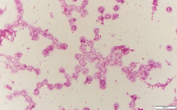 Acinetobacter baumannii〔アシネトバクター〕