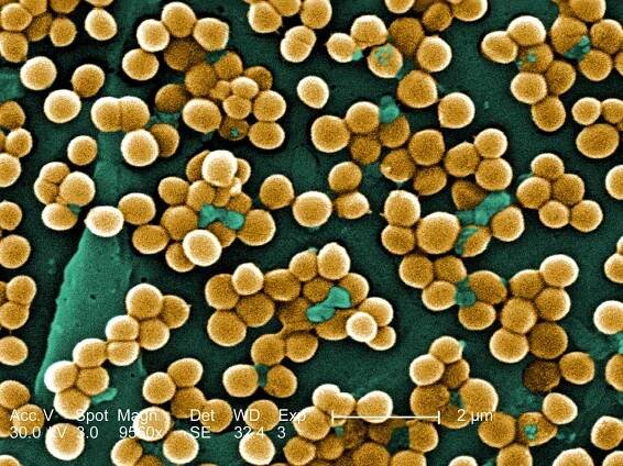 UK scientists’ breakthrough could save millions from drug-resistant infections