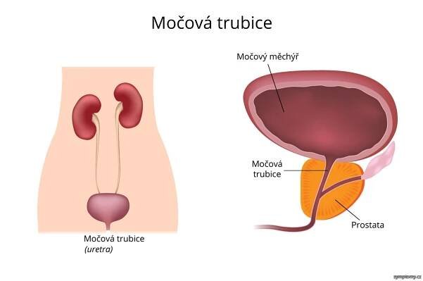 Močová trubice