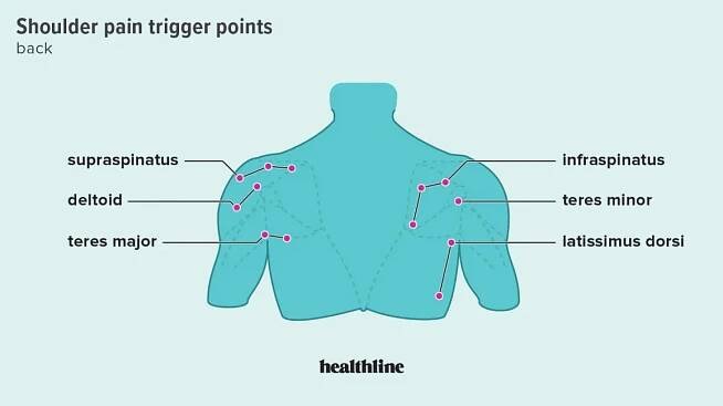 Frozen Shoulder Massage: Trigger Points & 10 Recommended Stretches