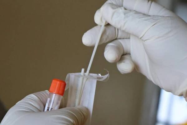 PCR test