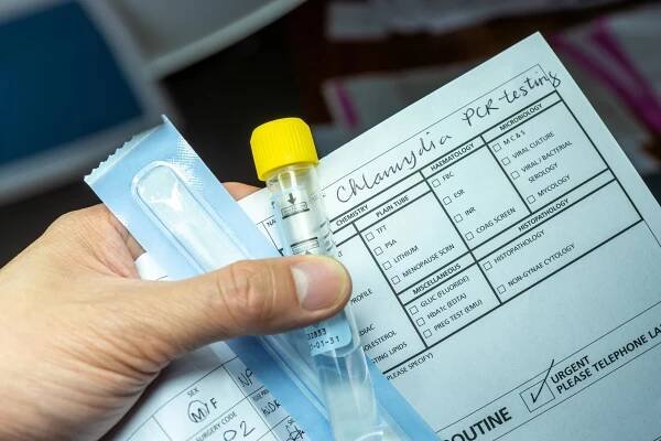 Healthcare provider holding chlamydia test and paperwork.
