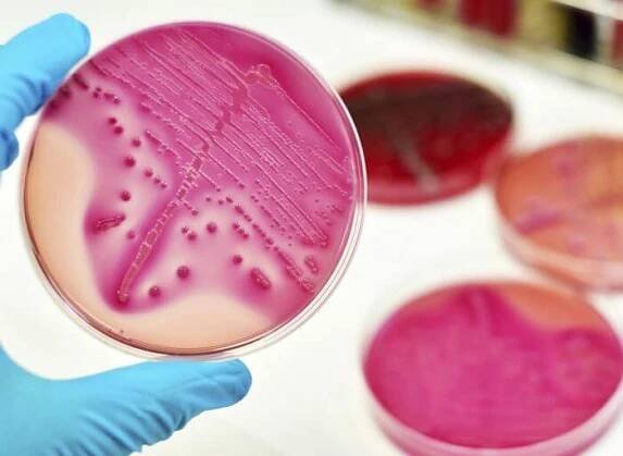 Mycobacterium avium