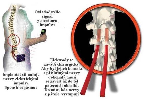 OSEL.CZ - detail obrzku