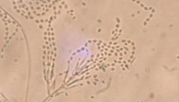 BugBitten Fungal compound inhibits transmission of malaria to mosquitoes