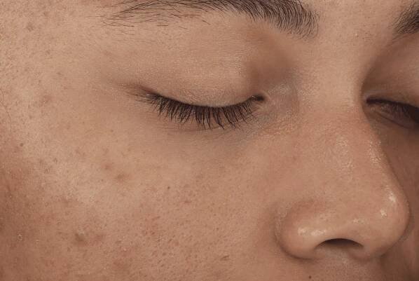 Diamond Glow Facial | ﻿﻿Irvine Medical Spa | New Skin & Body | Botox | Fillers | Laser Hair | Laser Skin
