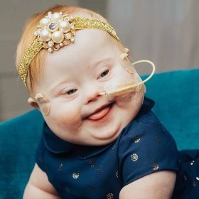 Vytoužená dcera se narodila s Downovým syndromem. Rodiče nelitují, naopak!