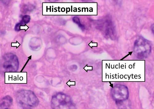 Histoplasma capsulatum - Wikipedia
