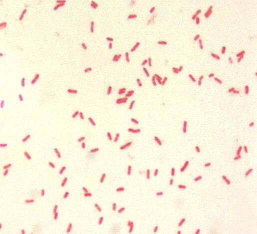 Yersinia pestis malé, gram, negativní, bacillus