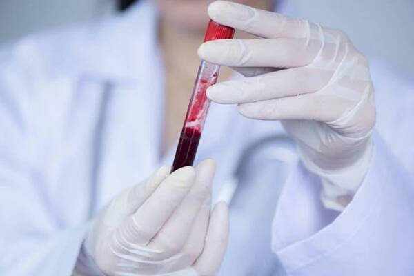 Krevní test odhalí rakovinu čtyři roky před prvními příznaky. Jde o významný krok v boji se zákeřnými nádory - AAzdraví.cz