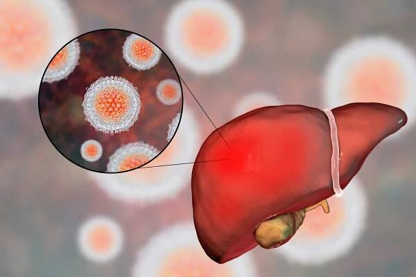3D illustration with close-up view of hepatitis C virus