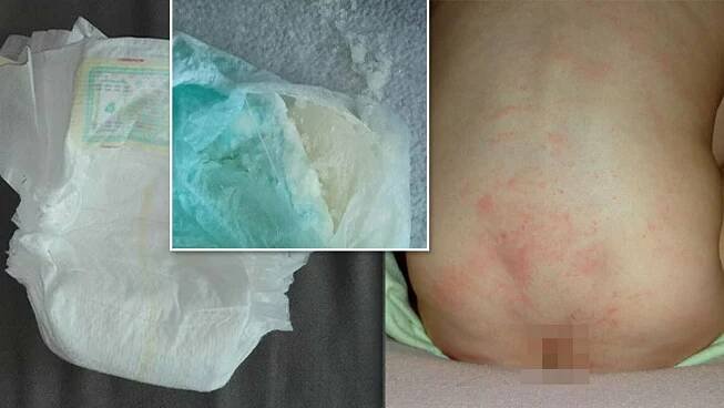 INFO.CZ | Vzpoura maminek proti novým Pampers. Z vylepšených plenek mají děti otlaky a opruzeniny