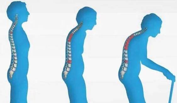 Jak léčit Osteoporózu a Ledvinové kameny? Hořčíkem! | Aluška.org
