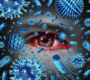 Konjunktivitida Oční infekce nebo infikované Růžové oči jako bakteriální a virové infekce nebo alergická reakce a alergie jako oftalmologický nebo optometrický symbol s 3D ilustračními prvky. — Stock obrázek