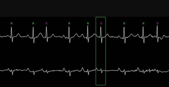 Prague ICU