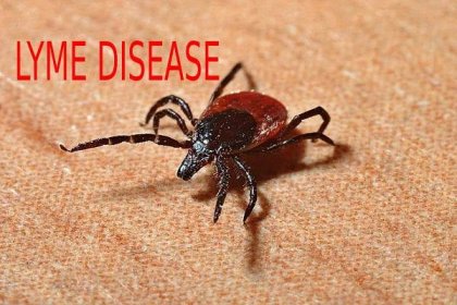 Lyme Disease - Causes, Symptoms, Diagnosis & Treatment