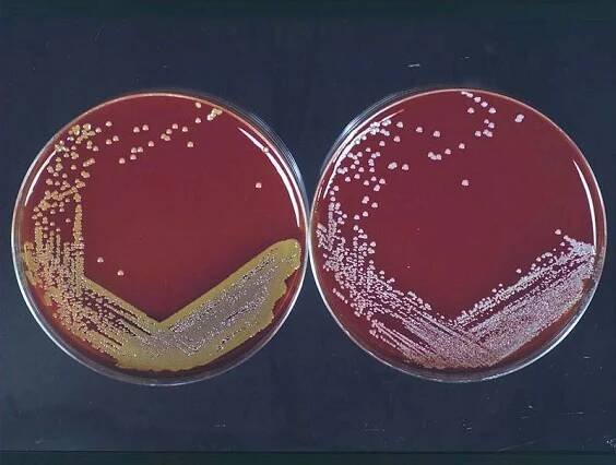 Staphylococcus aureus – patogeneze, diagnostika a léčba