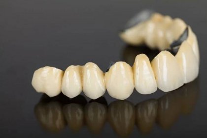 bigstock-Porcelain-Teeth--Dental-Bridg-48878828
