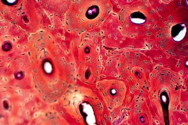 Svalové spojení kostí a pojivová tkáň. Histologie lidské kompaktní kostní tkáně pod mikroskopem pro výuku. — Stock obrázek