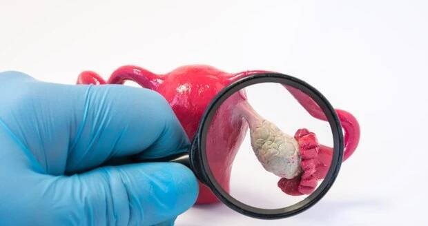 Zažívací potíže jako příznak rakoviny vaječníků: Květa měla 5,5 cm velký nádor, léčba je závod o čas