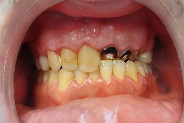 After