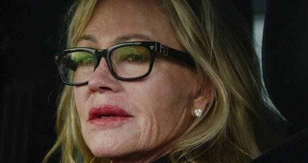 Melanie Griffith předvedla jizvu na tvářo