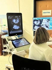 Nejmodernější metoda zachycení zhoubných nádorů prostaty ve znojemské nemocnici - Nemocnice Znojmo
