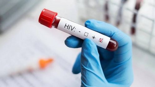 HIV pozitivních přibývá. Náklady na léčbu jsou téměř půl miliardy ročně