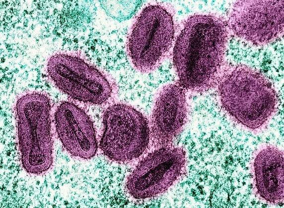 Laboratorní snímek Mpox viru