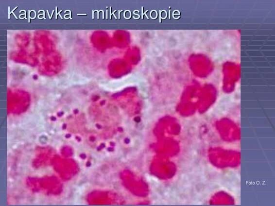 PPT - Lékařská mikrobiologie pro ZDRL PowerPoint Presentation, free download - ID:3489484