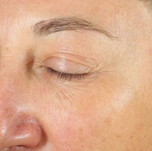 Black Diamond Eye Cream – 111SKIN