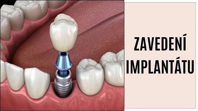 Zavedení implantátu