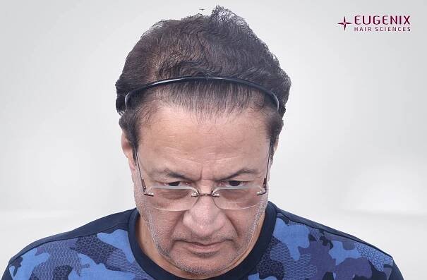 Arun Govil Head Down After