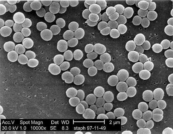 Soubor:Staphylococcus aureus 01.jpg – Wikipedie