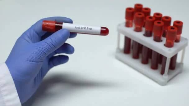 Test anti-Tpo, lékař zobrazeno vzorku krve do zkumavky, laboratorní výzkum, zdravotní vyšetření — Stock záběr