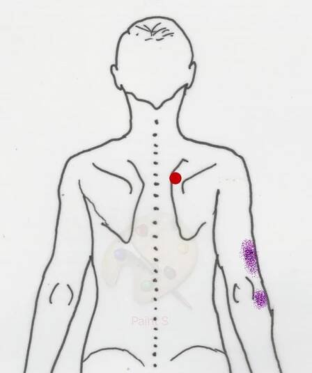 Trigger points - trapéz