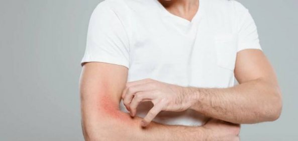 Svědění kůže může být příznakem rakoviny i infekce HIV