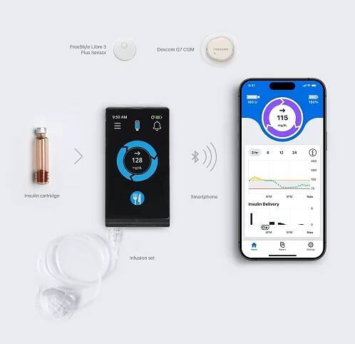 The iLet Bionic Pancreas with insulin cartridge, pump, infusion set, CGM sensor, and smartphone