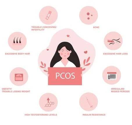 Syndrom polycystických ovarií: hormonální porucha a příčina neplodnosti Istock.com