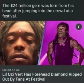 Lil Uzi Vert měl v čele drahokam za 24 milionů dolarů... skočil na festivalu mezi fanoušky, už ho nemá